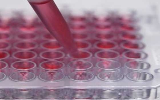   مصر اليوم - الخلايا الجذعية قد تعالج سلس البول