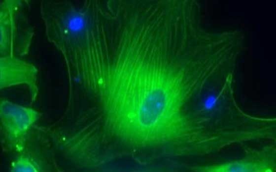  مصر اليوم - علماء يتوصلون إلى الخلل الجينى المسئول عن الاصابة بالفصام