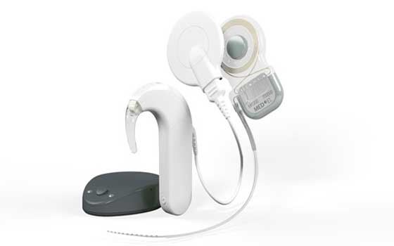   مصر اليوم - أمل جديد لعلاج صمم الأطفال عن طريق زراعة قوقعة الأذن