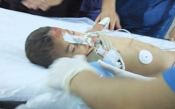   مصر اليوم - ارتفاع حصيلة العدوان الإسرائيلي إلى 98 شهيدًا و670 جريحًا