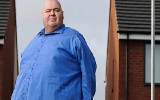   مصر اليوم - السمنة ترفع نسبة الوفيات أكثر من التدخين