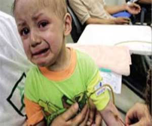 مصر اليوم - إصابة 24 بالقراع العسلي و 25 بالغدة النكافية في الأقصر