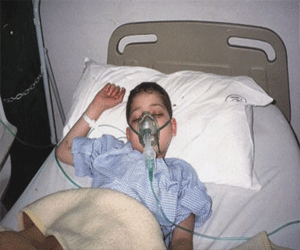 مصر اليوم - انتشار عدوى النكاف أقل من معدل انتشار أمراض الطفولة الشائعة