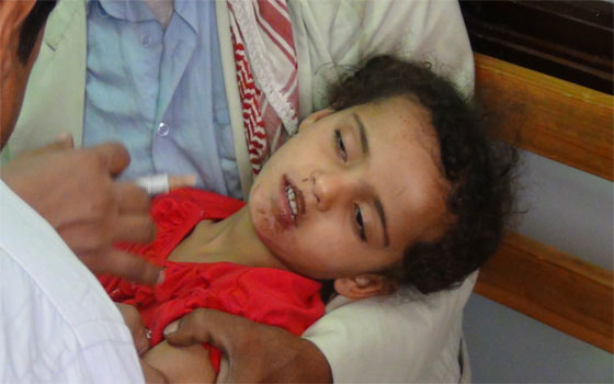   مصر اليوم - الكلاب المسعورة تتسبب في غلق مدارس زنجبار جنوب اليمن